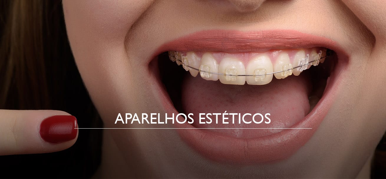 Aparelho Invisalign no Rio de Janeiro • Klariss Boutique de Odontologia